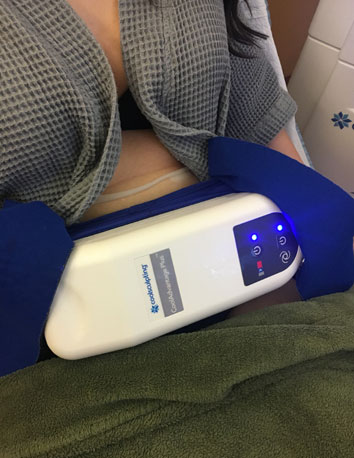 CoolSculpting the Stomach at Quintessa Aesthetic Center