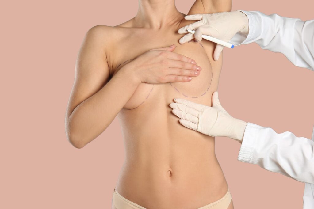 Breast reduction incisions are placed along natural contours to reduce visible scarring.