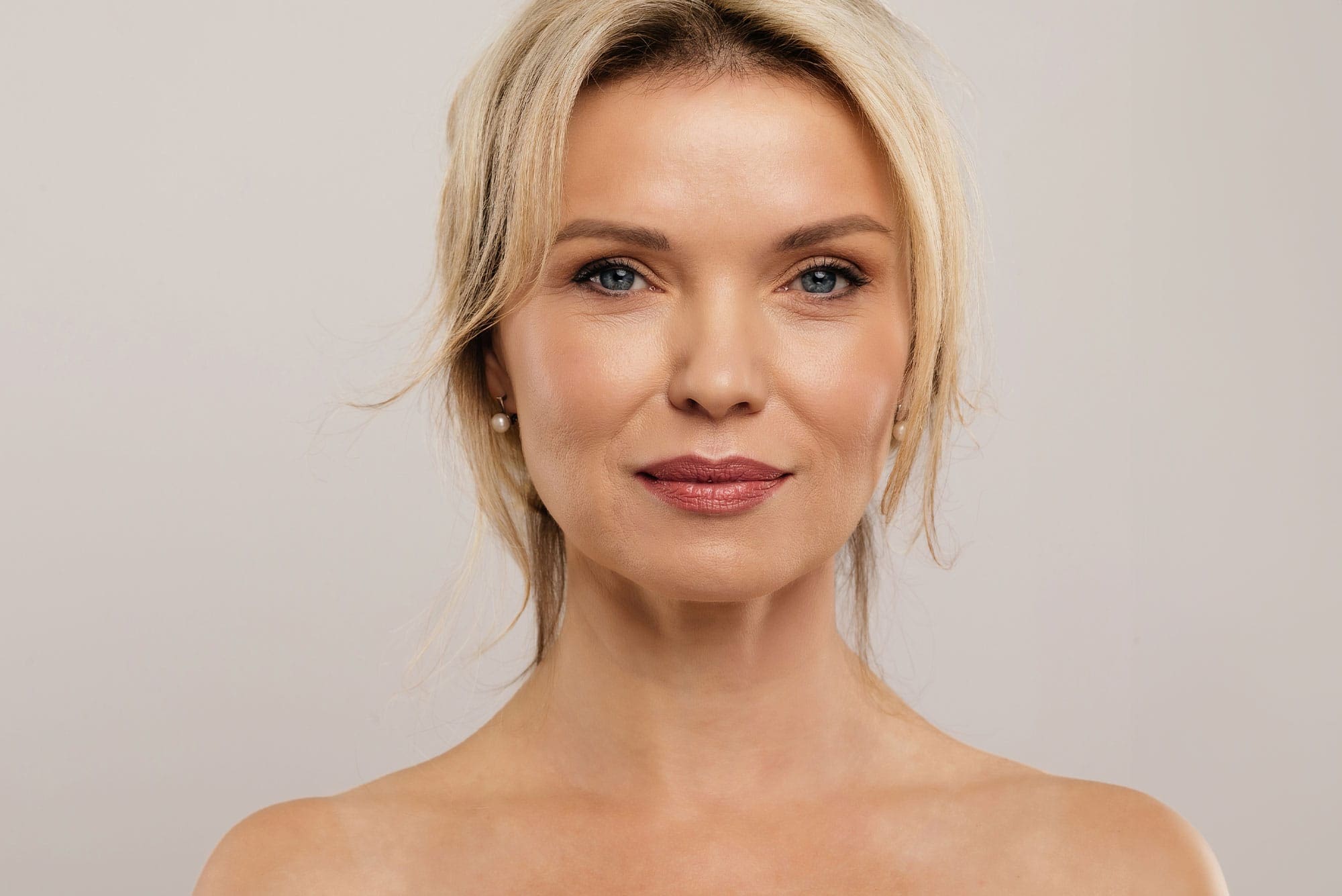 woman's face after getting Botox